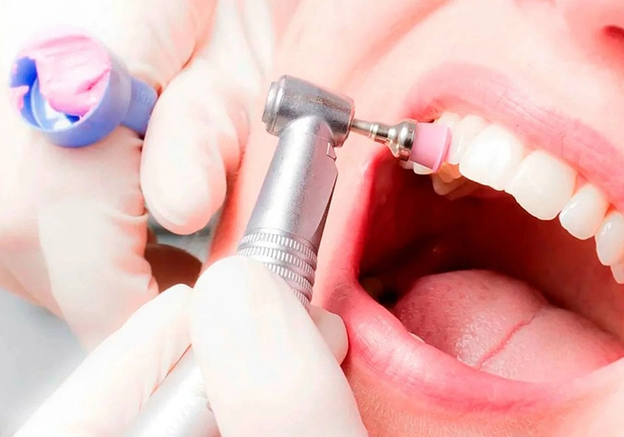 Dentalhygiene Zug — professionelle Zahnreinigung